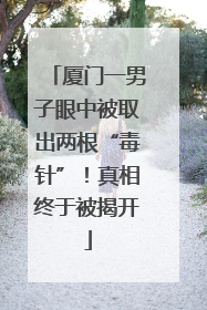 厦门一男子眼中被取出两根“毒针”！真相终于被揭开